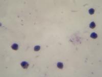 Malaria project thumbnail