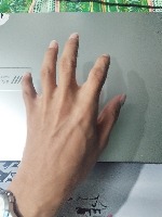 Hand Signs project thumbnail