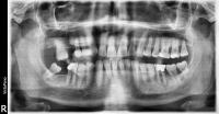 dental-pathology-v1 project thumbnail