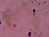Andrew Malaria Project project thumbnail