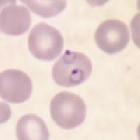 segmentasi malaria project thumbnail