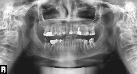 xray project thumbnail