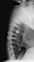 thoracic_lat project thumbnail