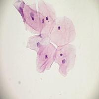 Cervical project thumbnail