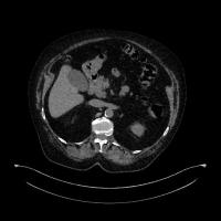 Lungs project thumbnail