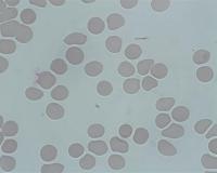 ProyMalaria project thumbnail