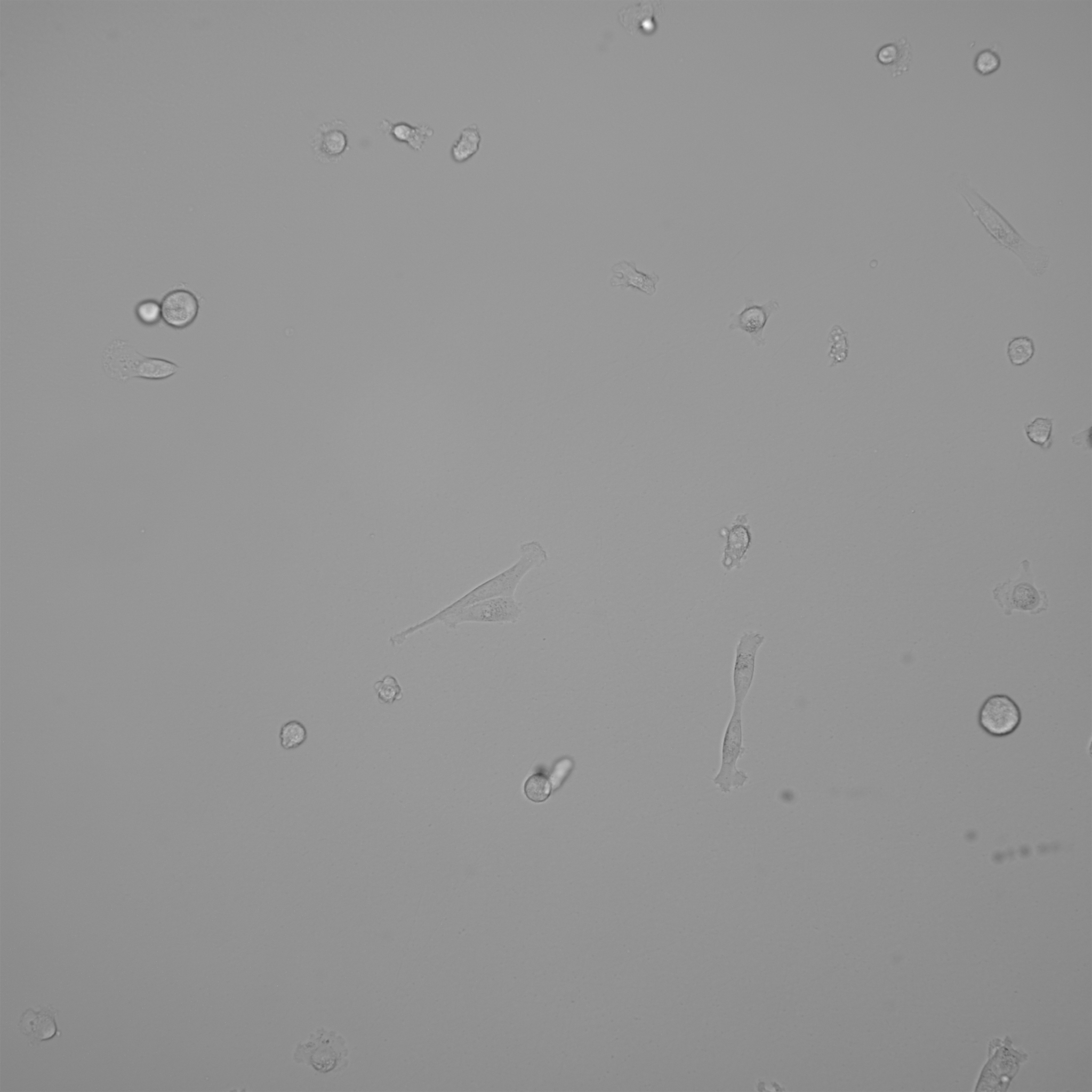 Cells - YOLO V5 Object Detection Model by Cell detection