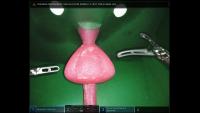 Seg-GreenPix project thumbnail