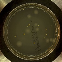 Microbial_Colony_Detection project thumbnail
