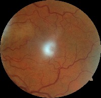 Dataset Image