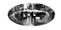 dentalai-i4clz-fsod-txmm project thumbnail