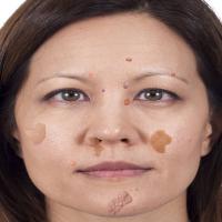 skin issue project thumbnail