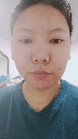 Skin Problems Detection project thumbnail