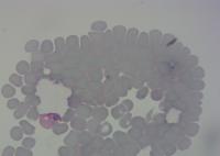 Vivax BBBC041v1 project thumbnail