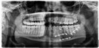 Detector project thumbnail