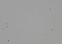 Cell-detection project thumbnail