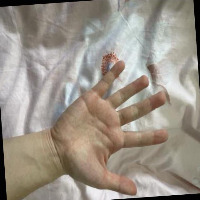 Hand Detection Project project thumbnail