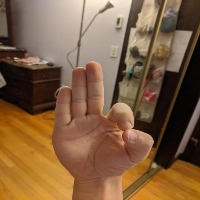 Hand Detection Project project thumbnail
