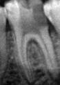 my first segmentation  project thumbnail