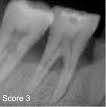 Tooth-Detection-YOLO11 project thumbnail