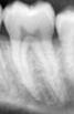 detection project thumbnail
