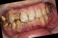 dental project thumbnail