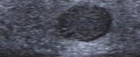 thyroid_diagnose project thumbnail