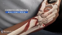 Bone-fracture project thumbnail