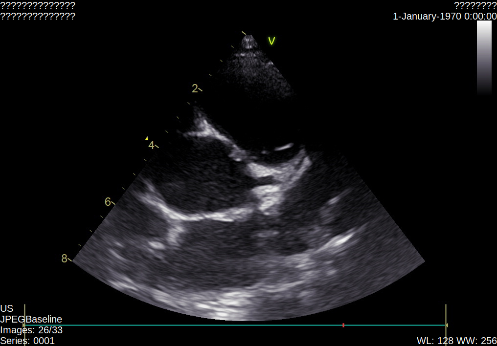 echoview Classification Dataset and Pre-Trained Model by echo