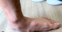 Foot Classification project thumbnail