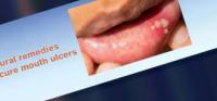 detection-oral-lesions project thumbnail