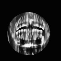 Panoramic-xray project thumbnail