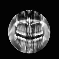 COCO-dental-xray-dataset project thumbnail