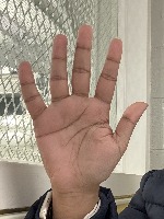 Gestures project thumbnail