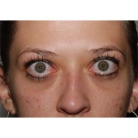 Eye scanner 2 project thumbnail