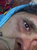 Catarata project thumbnail