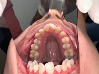 Dental project thumbnail