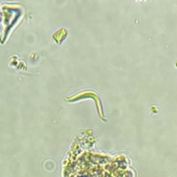 Phytoplankton-Research project thumbnail