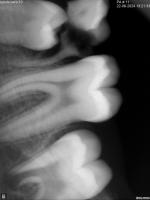 xray btach 3 project thumbnail