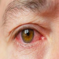 Eye Dataset project thumbnail