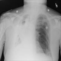 nih-xray-itazg-xeoi project thumbnail