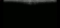Final Vein Finder project thumbnail