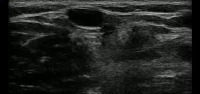 Vein Finder Based on 12 Particip project thumbnail