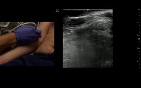 Vein Finder Based on Online Images and Videos project thumbnail