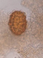 Ascaris_SSEG project thumbnail