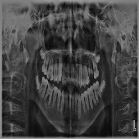 dental project thumbnail