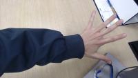 Fingers project thumbnail