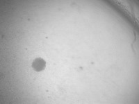 Oocyte Detect project thumbnail