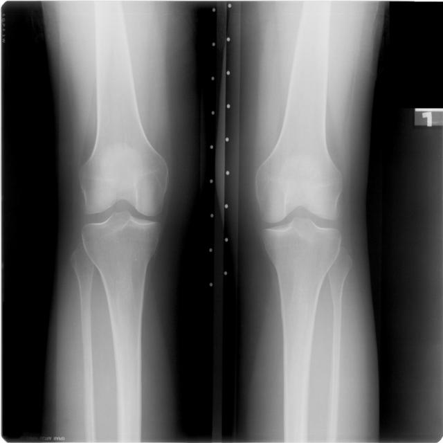 Knee Joint Object Detection Dataset by Abiodun Projects