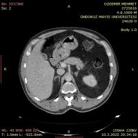 mehmet özdemir project thumbnail